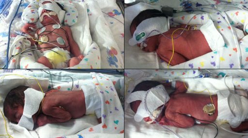 khou_1-in-70m-odds-houston-woman-gives-birth-to-two-sets-of-identical-twins--191745341_s