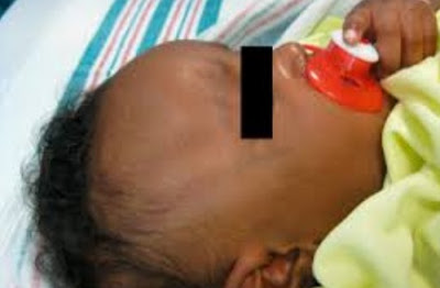 baby girl censored face
