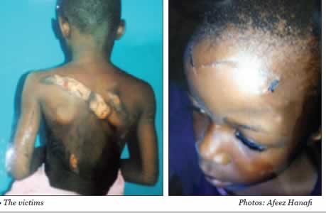 boys tortured with hot knife by step mother
