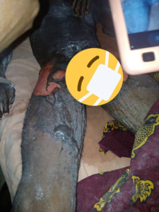 Photos: Wife baths husband with peppered boiling water in Delta