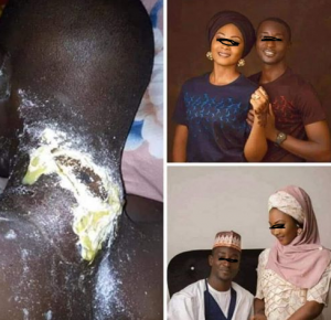 Newly wed lady poisons her husband with rat poison
