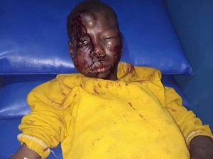 Man disfigures young nephew’s face for stealing N3000