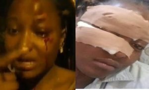 FUTA student allegedly battered for turning down sexual advances from Policemen