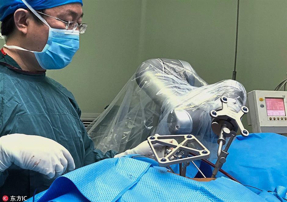 china robotic surgery