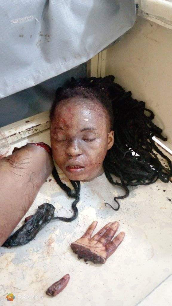 Abuja Slay Queen butchered by Ritualists (GRAPHIC PHOTOS)