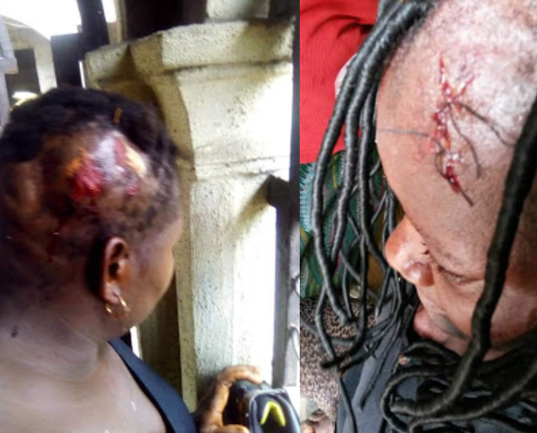 Man on the run after reportedly hitting wife's head with Pestle (Graphic Photos)
