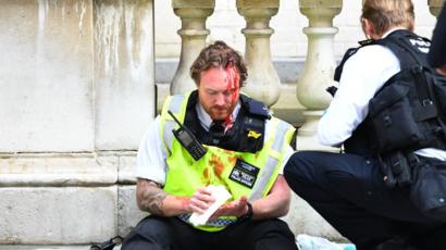 Injured Bristol Police Officer