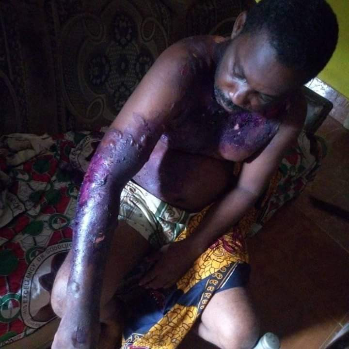 Wife pours hot water on Sleeping Husband after slapping her