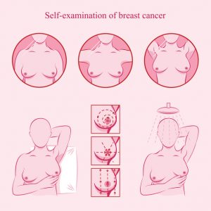 Importance of Breast self examination for breast cancer