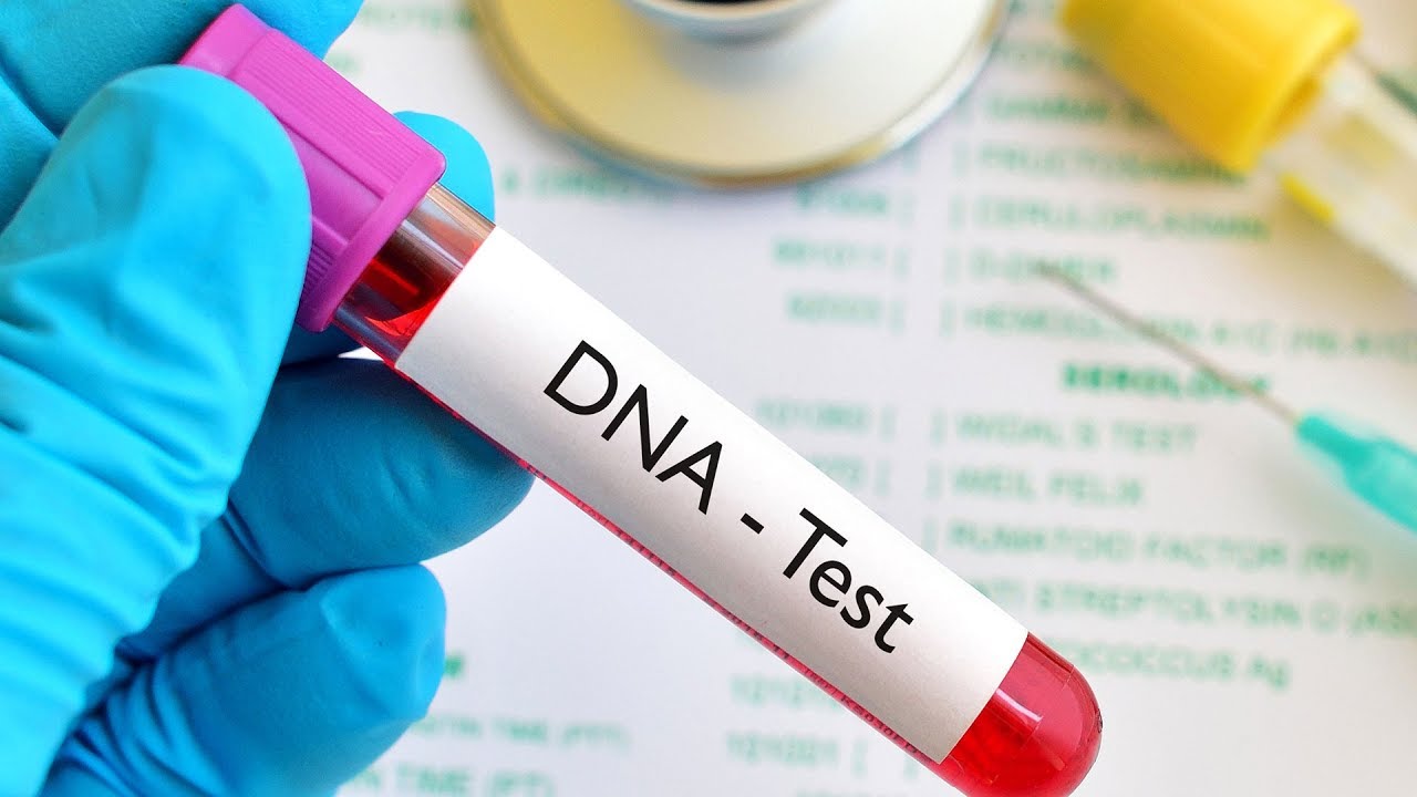 DNA Test - paternity fraud in Nigeria